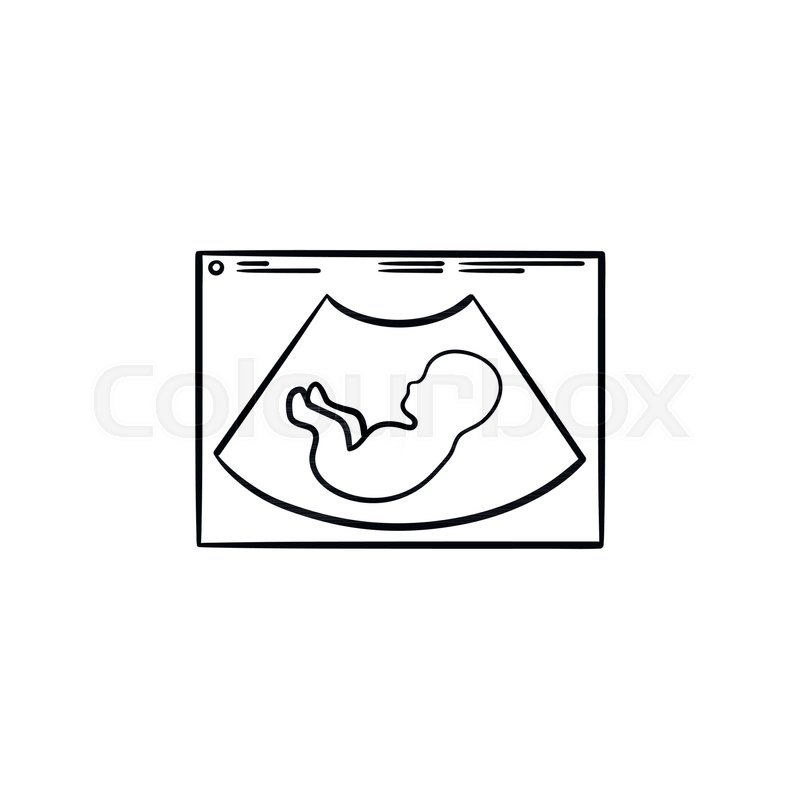 800x800 Fetus Silhouette On Ultrasound Hand Drawn Outline Doodle Icon - Fetus Sketch