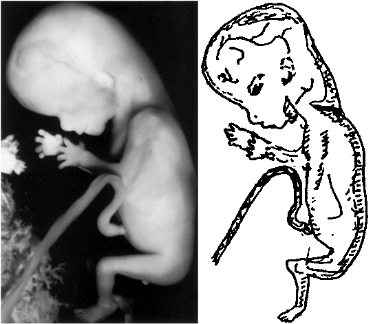542x471 The Stages Of Embryological Fabrication By Dr. Lactantius The - Fetus Sketch