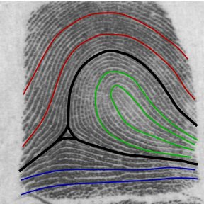 288x288 Three Major Fingerprint Pattern Types (A) Whorl, (B) Loop, And (C - Fingerprint Sketch