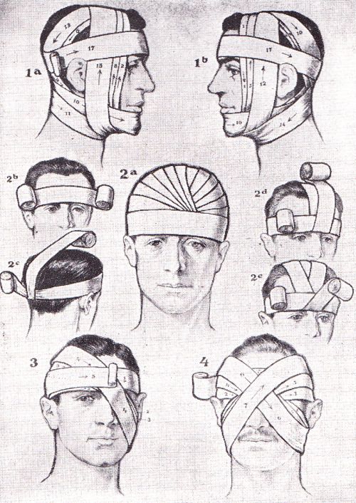 500x706 First Aid Bandaging Techniques. Richards Topical Encyclopedia - First Aid Sketch