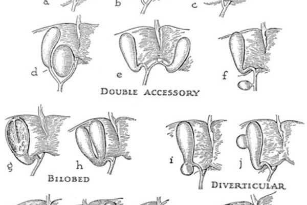 600x400 Liver Cleaning Part 2 - Gallbladder Sketch