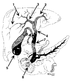 235x270 Surgical Recall - Gallbladder Sketch