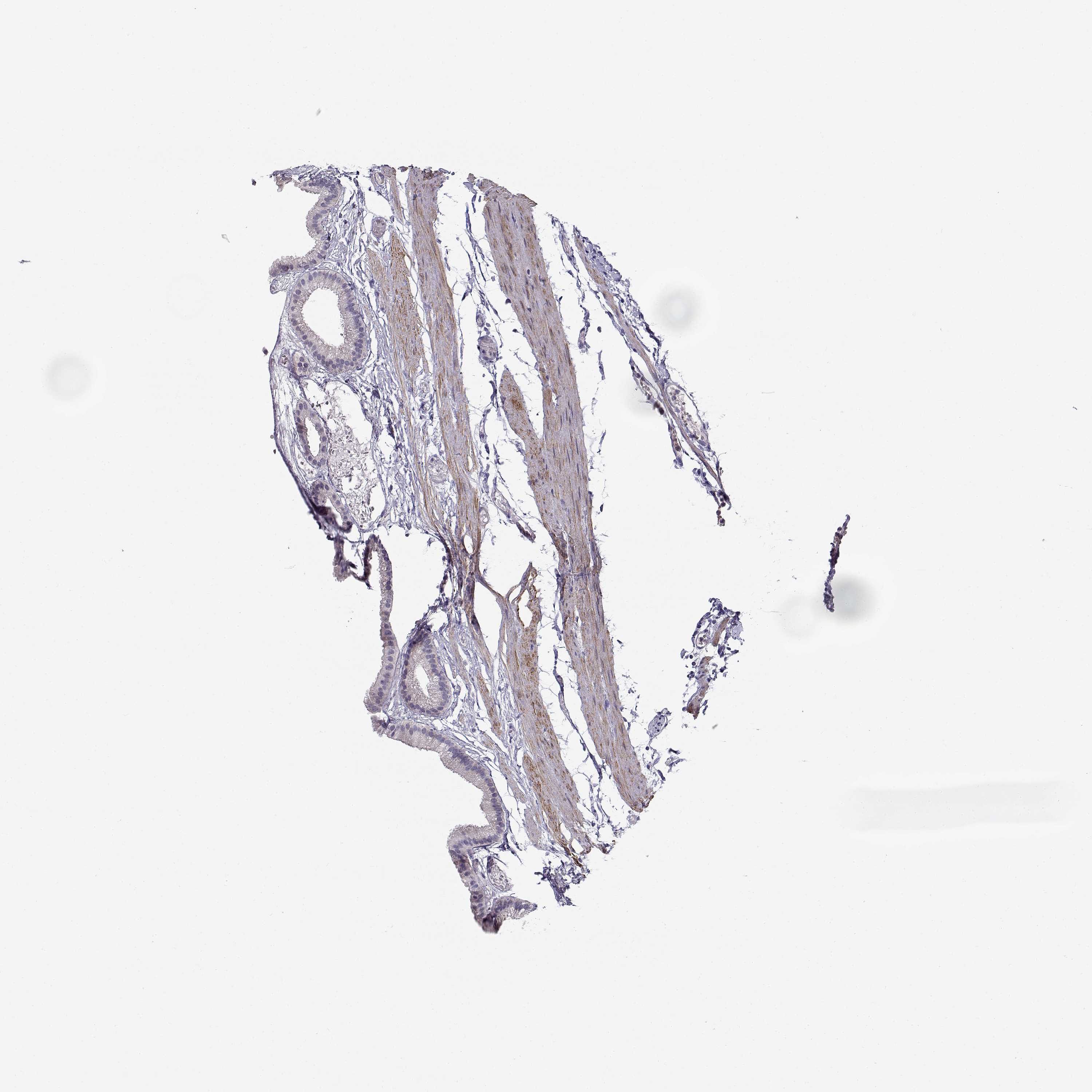 3000x3000 Tissue Expression Of Creb3l3 - Gallbladder Sketch