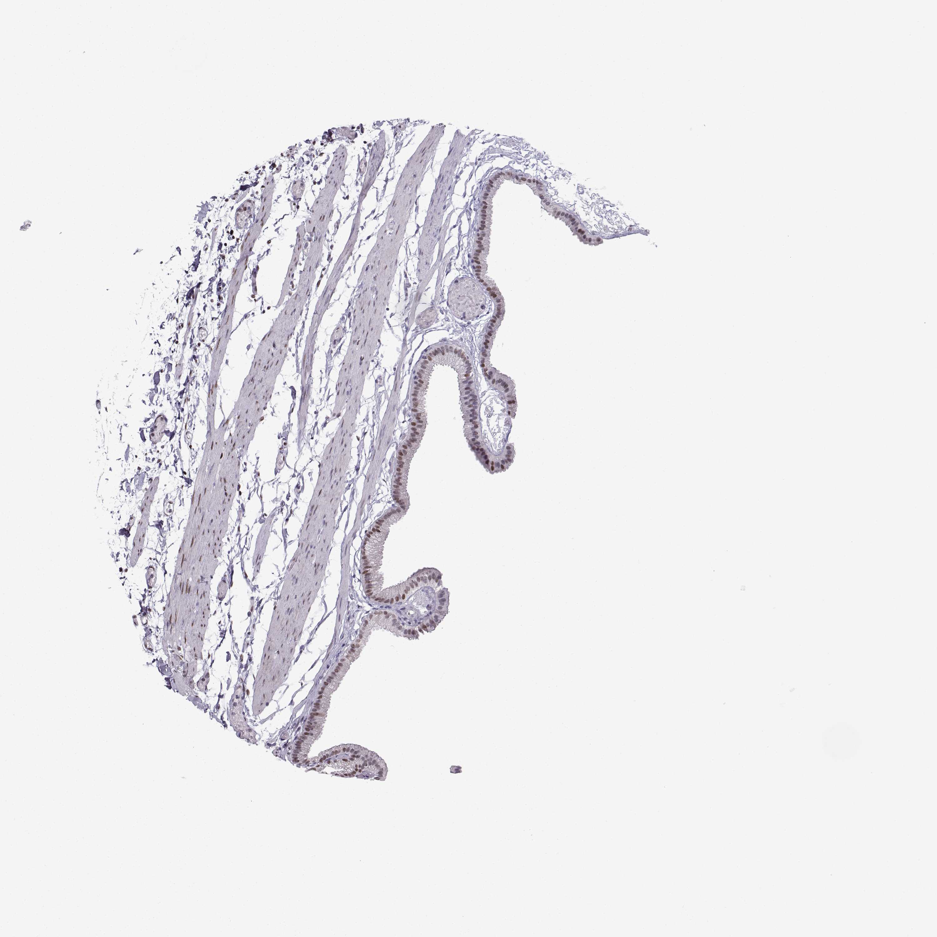 3000x3000 Tissue Expression Of Ezh1 - Gallbladder Sketch