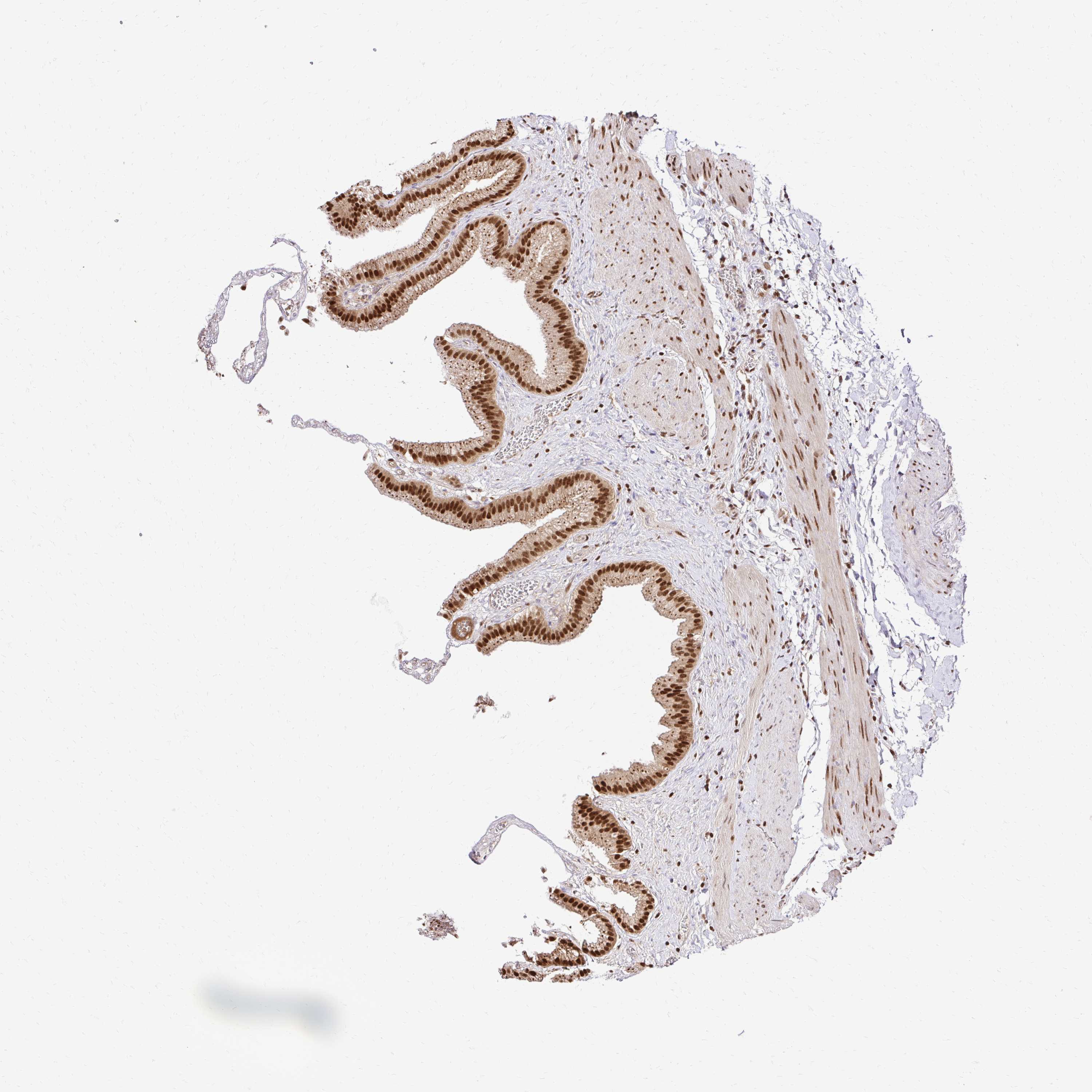 3000x3000 Tissue Expression Of Glyr1 - Gallbladder Sketch
