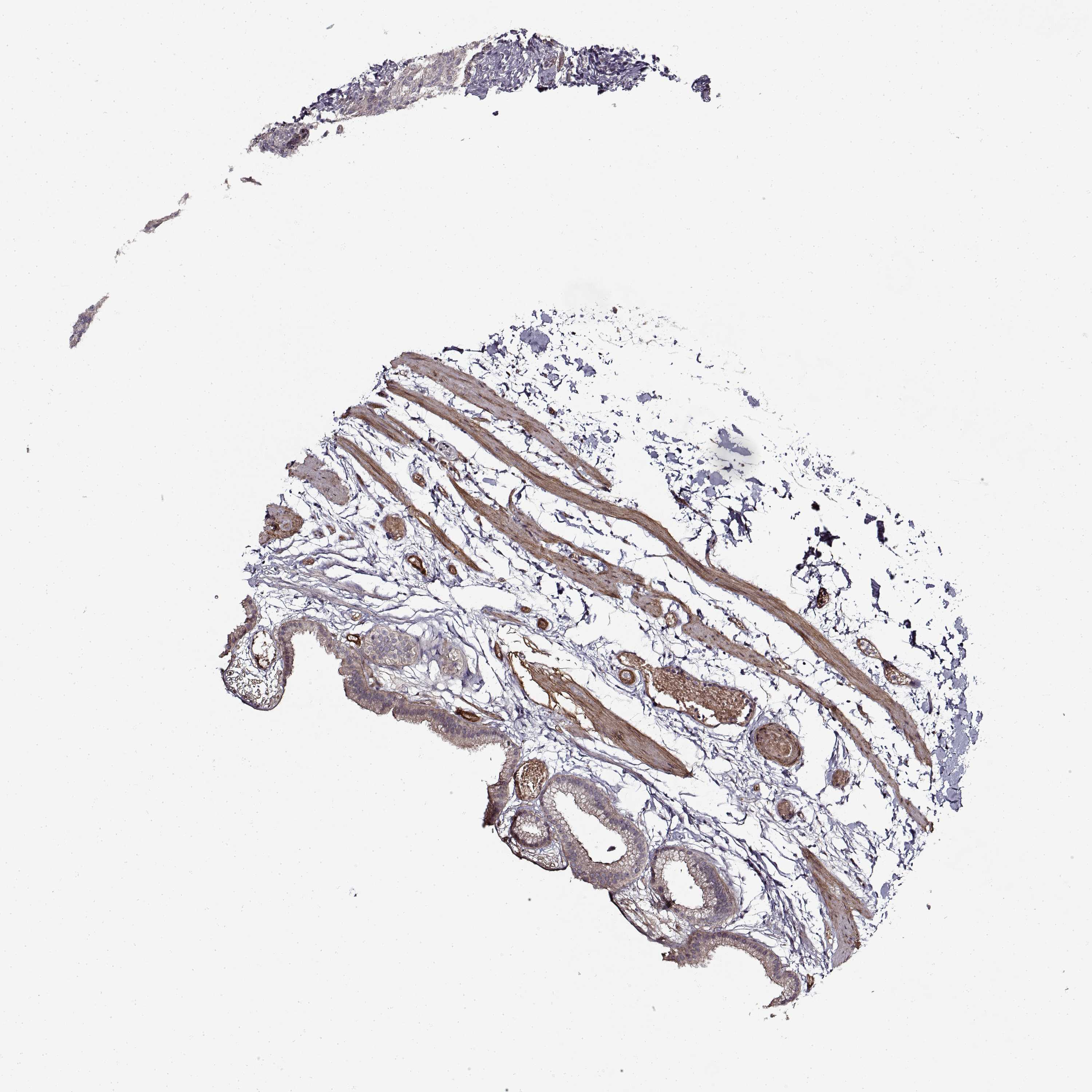 3000x3000 Tissue Expression Of Lamb2 - Gallbladder Sketch