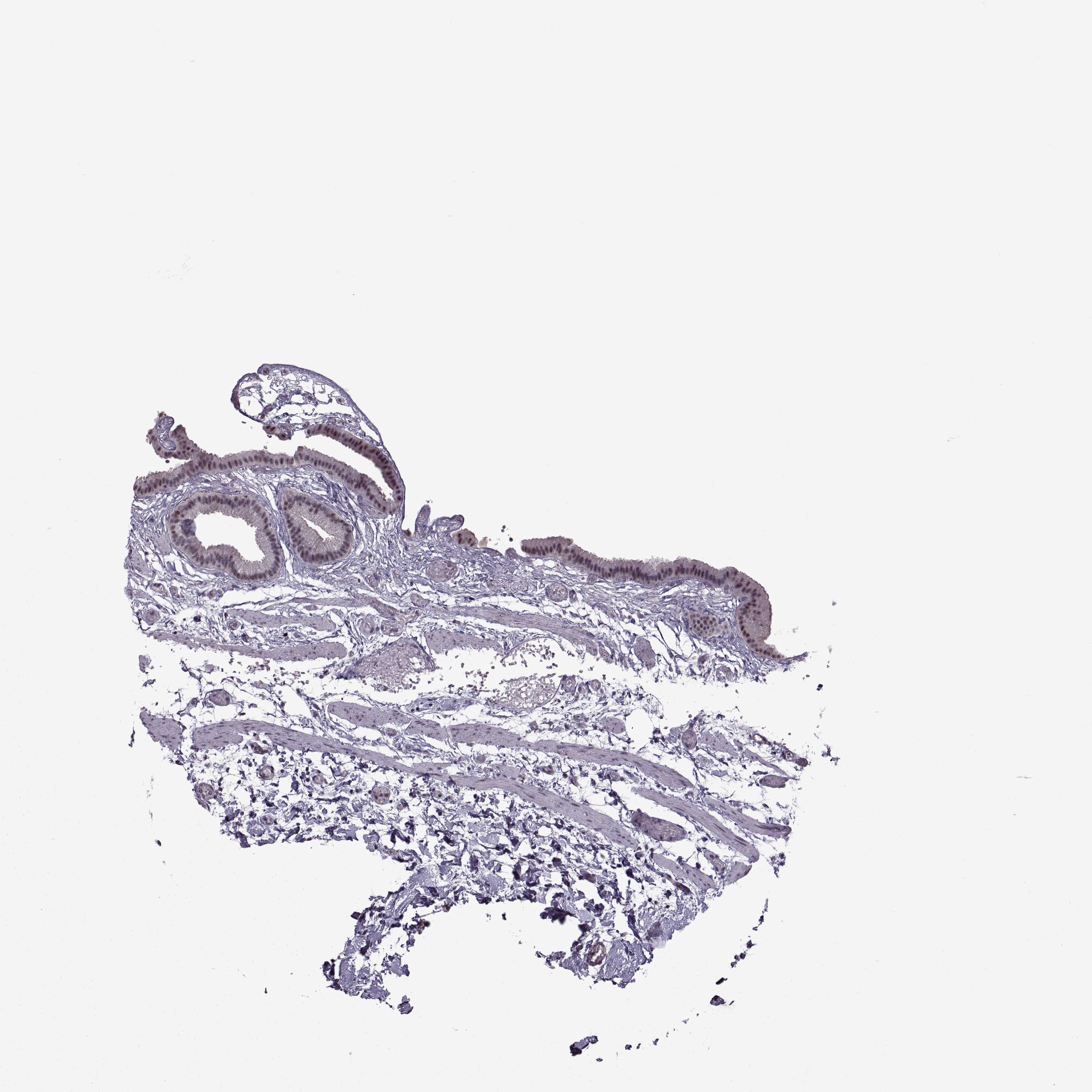 3000x3000 Tissue Expression Of Magea4 - Gallbladder Sketch