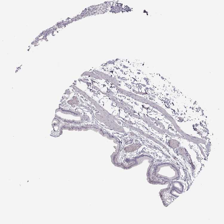750x750 Tissue Expression Of Pnmt - Gallbladder Sketch