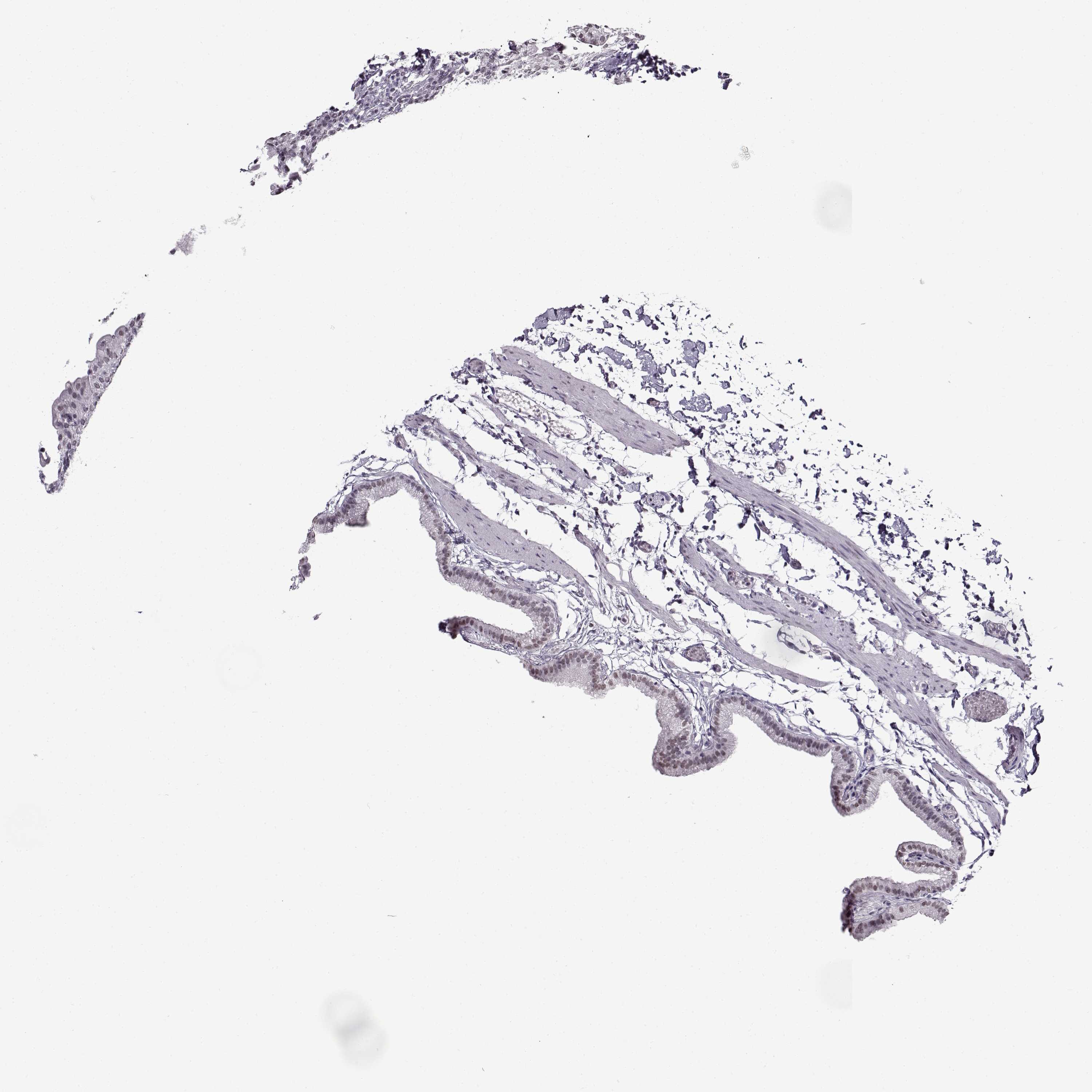 3000x3000 Tissue Expression Of Prmt8 - Gallbladder Sketch
