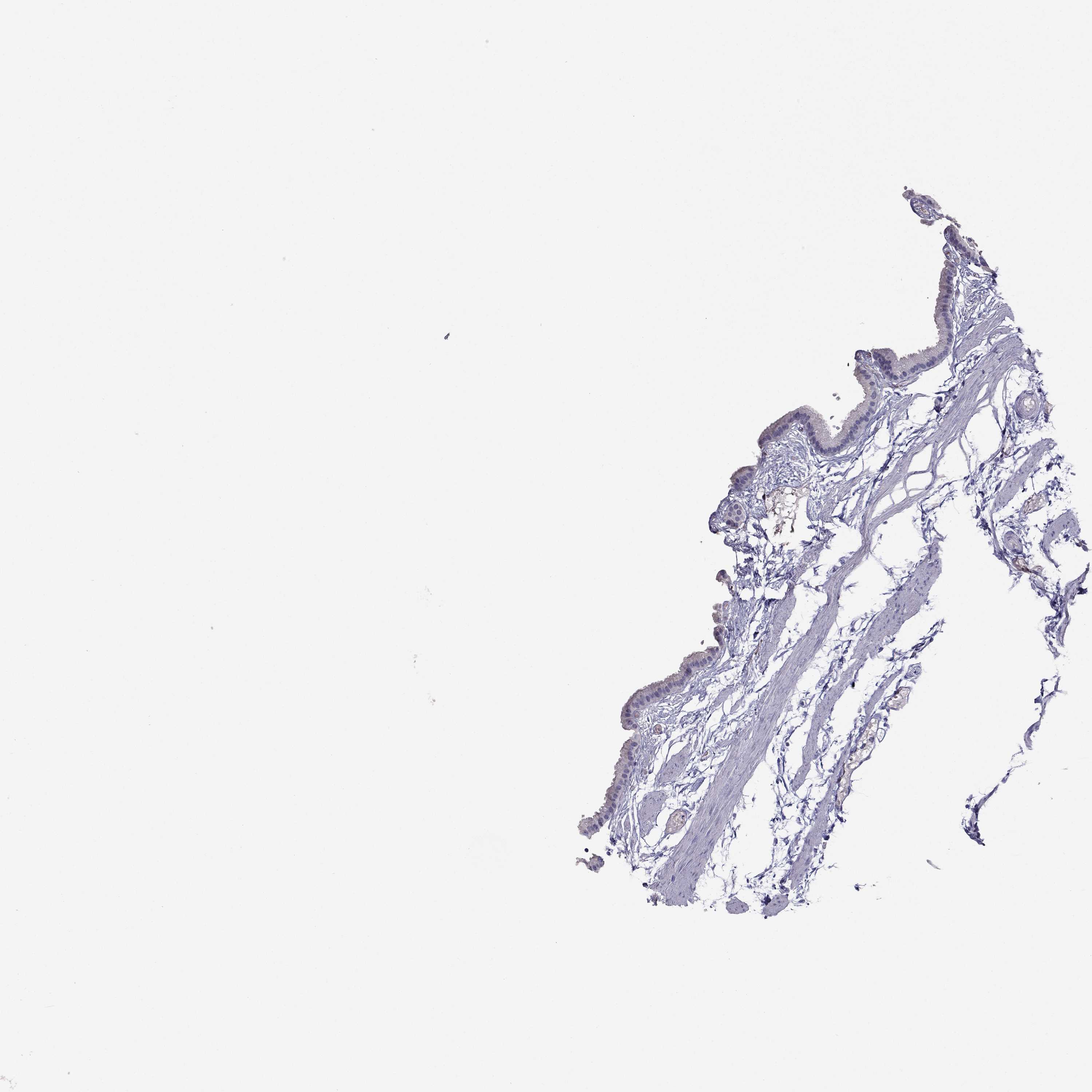 3000x3000 Tissue Expression Of Rho - Gallbladder Sketch