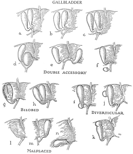 450x521 Ultrasound Leadership Academy Ruq Ultrasound Em Curious - Gallbladder Sketch