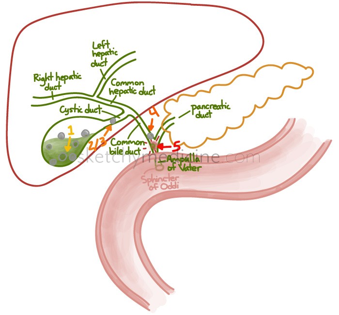 700x650 Gallbladder Sketchy Medicine - Gallbladder Sketch