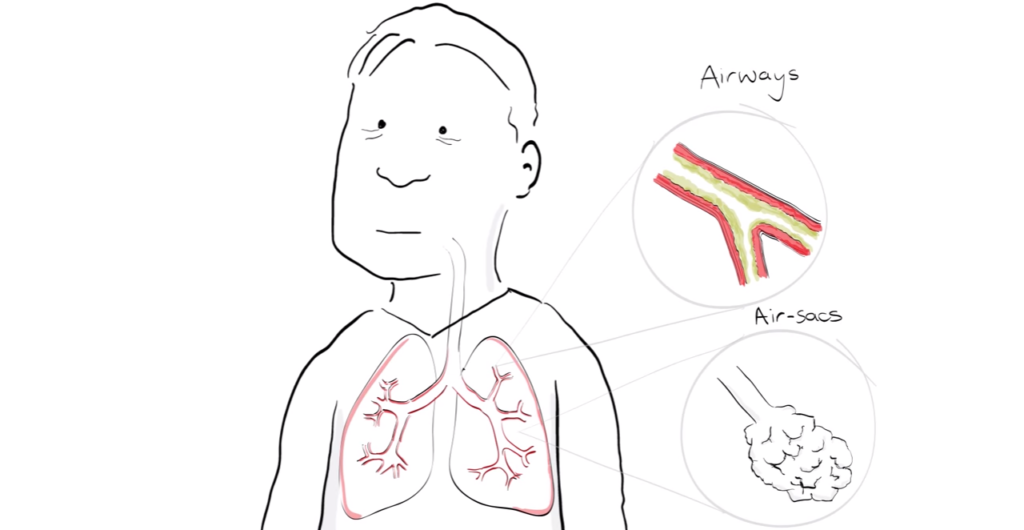 1024x530 Health Sketch Archives Support Chss - Health Sketch