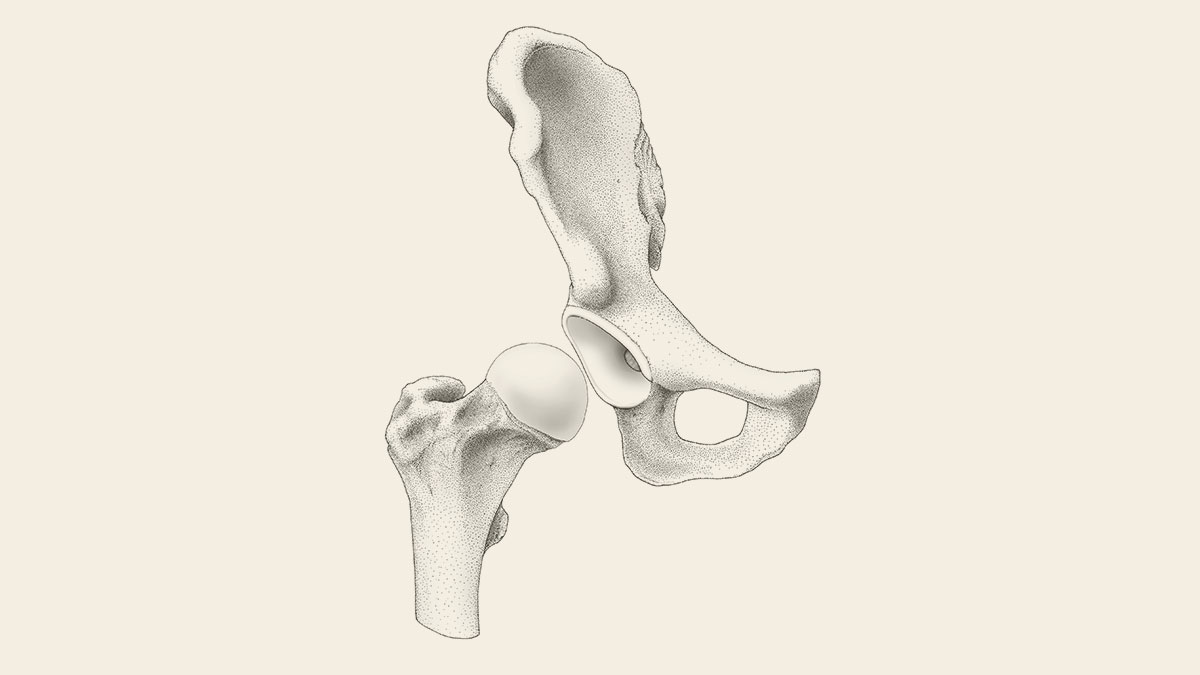 1200x675 Hip Surgery Services Dr Bruno Gomes - Hip Sketch
