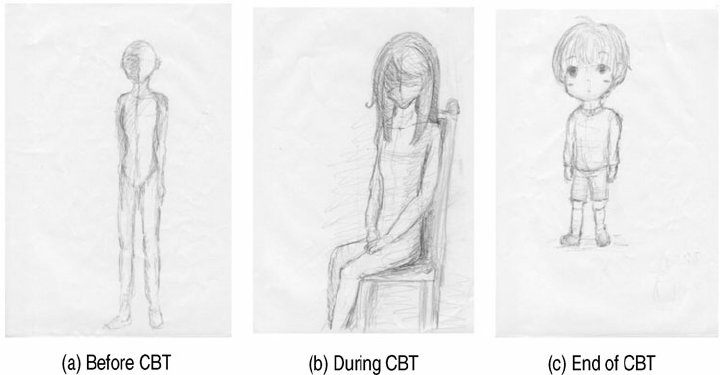 720x375 Projective Drawing (Draw A Person Test) By Case B (Aya). ( A - How To Draw A Sketch Of A Person