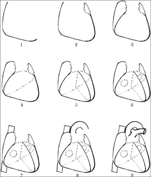 512x600 The Steps For Drawing A Sketch Of Human Heart. (1) Righ Open I - Human Heart Sketch Images