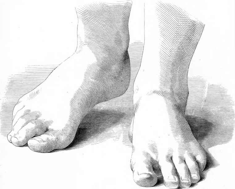 761x613 Sketches Of Human Anatomy - Human Leg Sketch