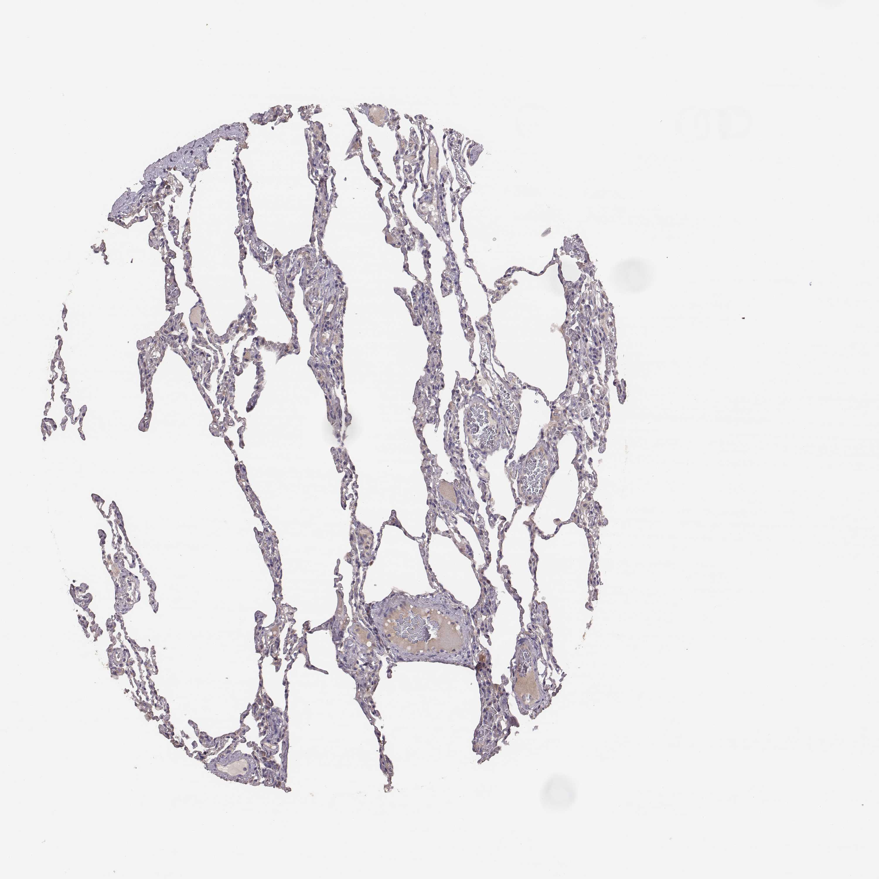 3000x3000 Tissue Expression Of Havcr1 - Human Lung Sketch
