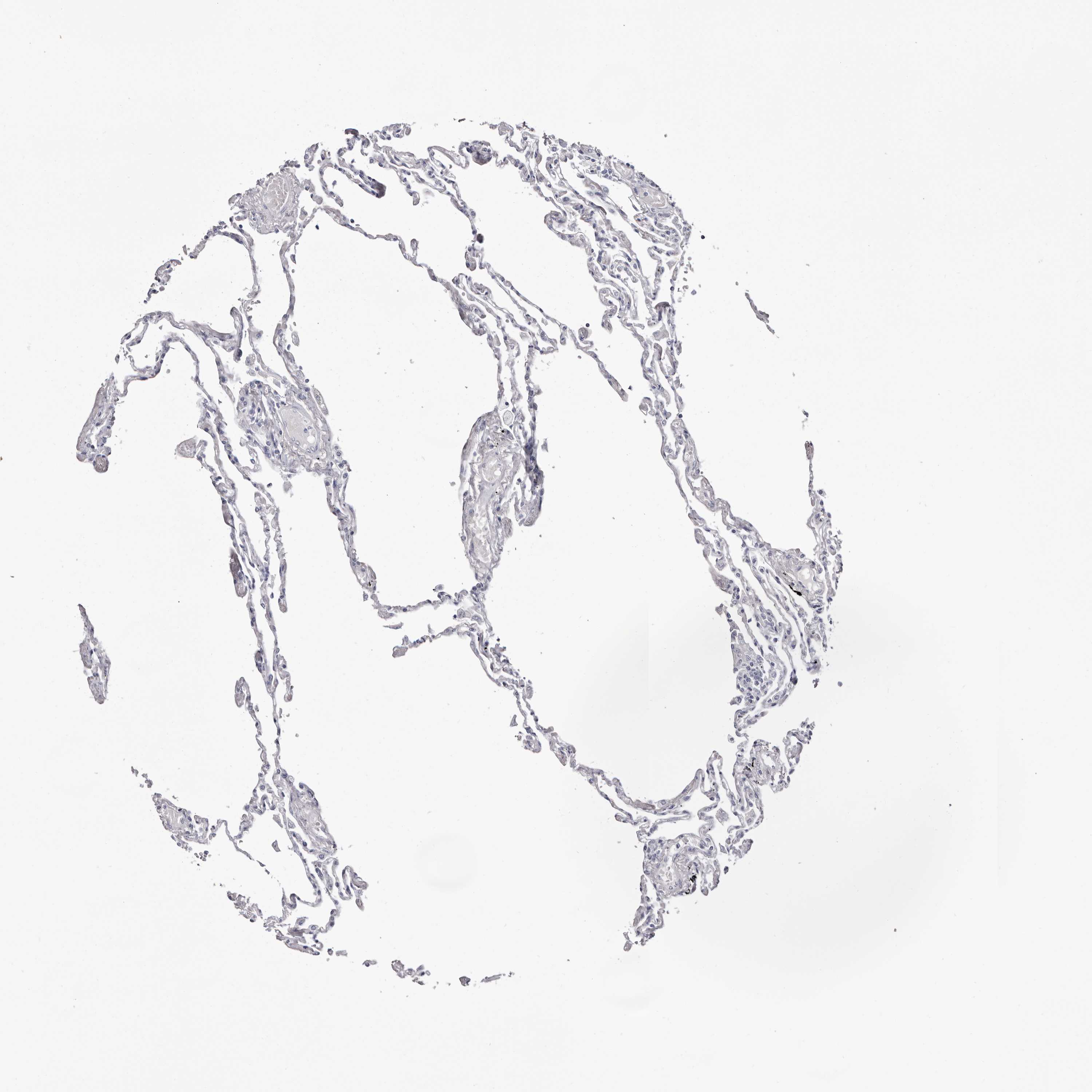 3000x3000 Tissue Expression Of Lpo - Human Lung Sketch