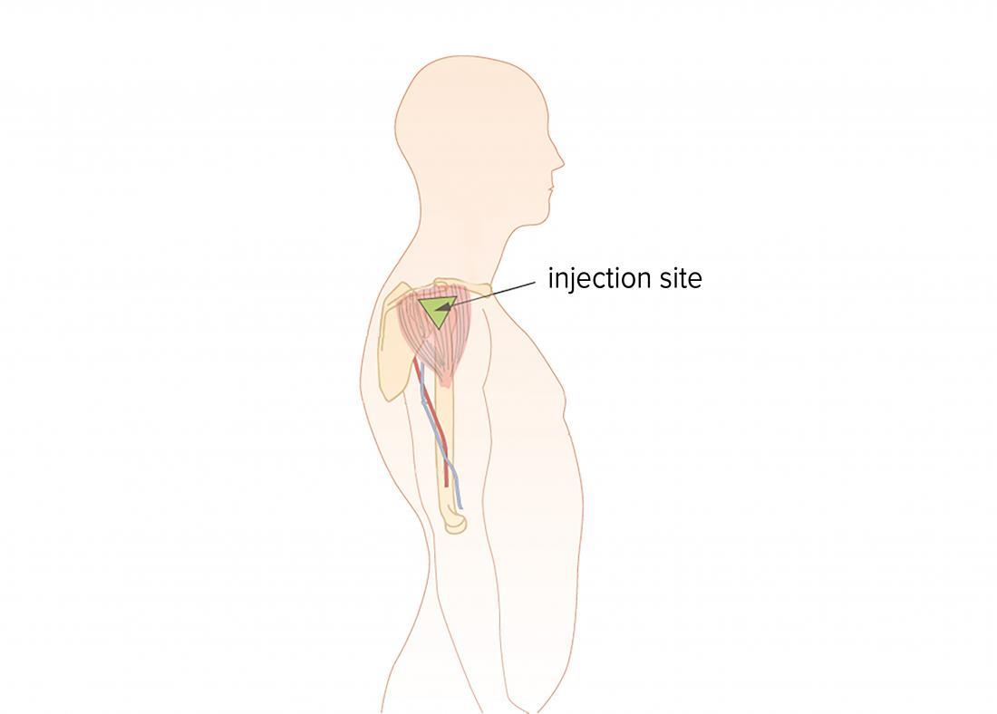 1100x788 How To Give An Intramuscular Injection Grand Medicine - Injection Sketch