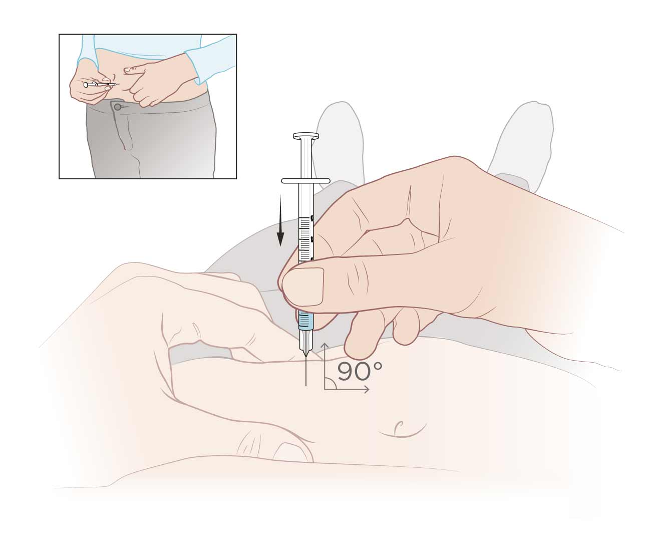 1296x1118 Subcutaneous Injection Definition And Patient Education - Injection Sketch