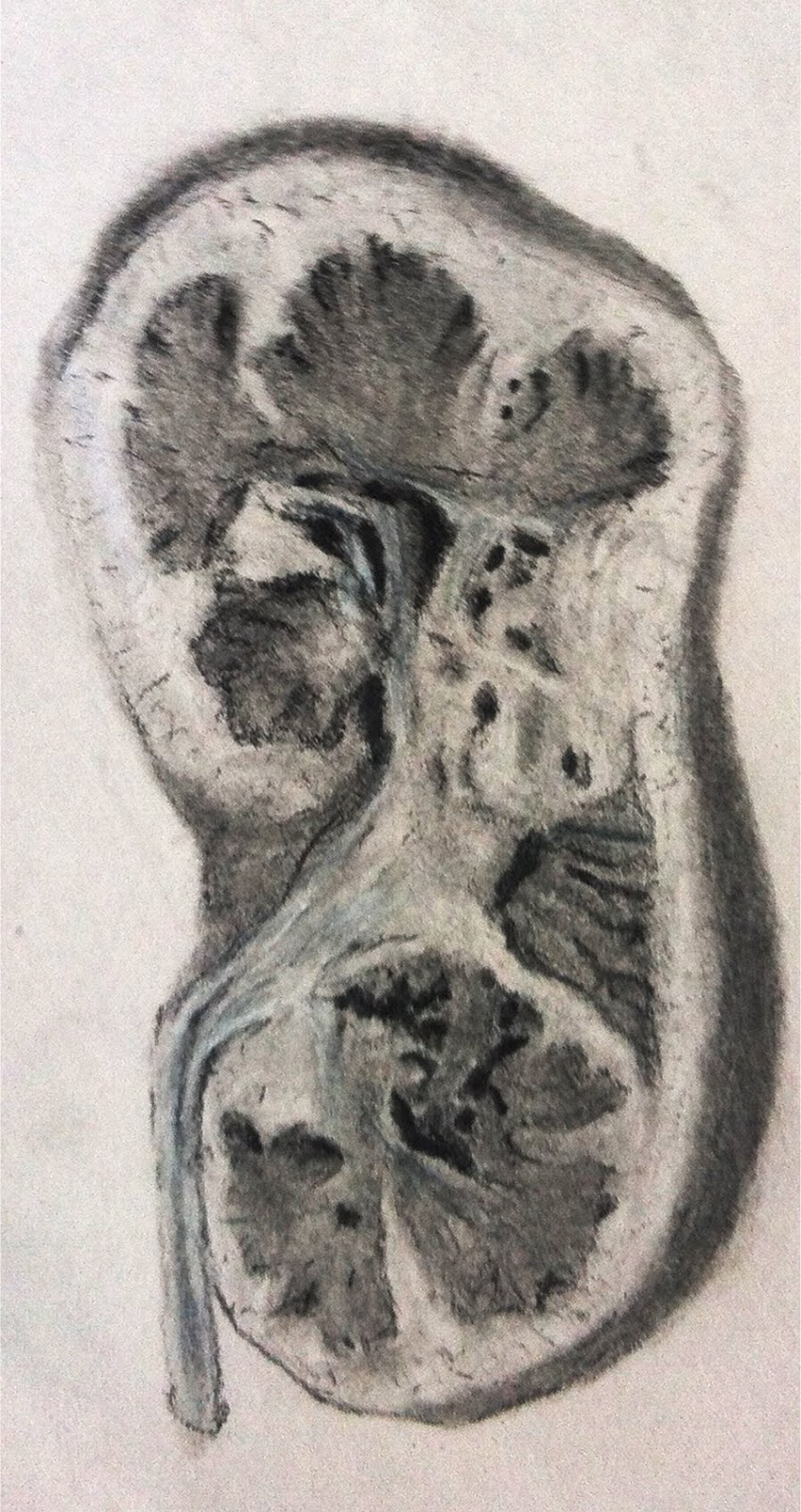 847x1600 Kidney Health Blog - Kidney Sketch