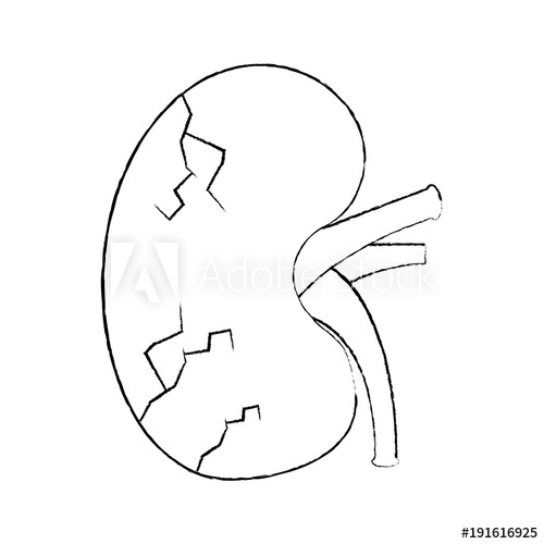 500x500 Sick Human Kidney Organ Veins Part Icon Vector Illustration Sketch - Kidney Sketch
