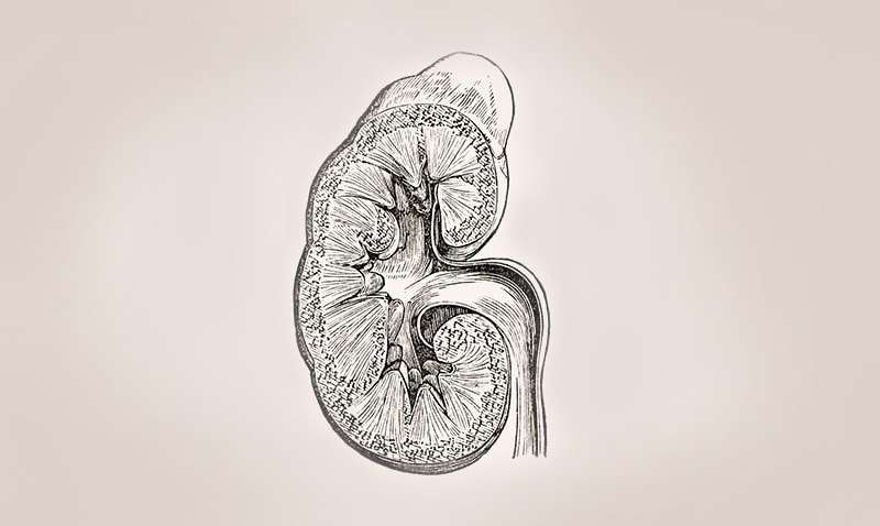 800x478 High Burden, High Cost And Low Awareness Of Kidney Disease In The - Kidney Sketch
