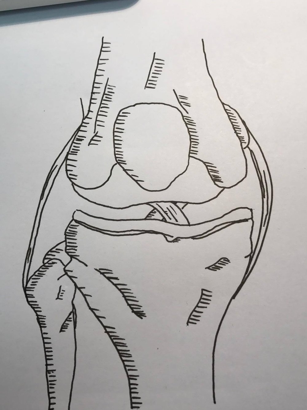 1000x1335 Motionplus Motion Plus Clinic - Knee Sketch