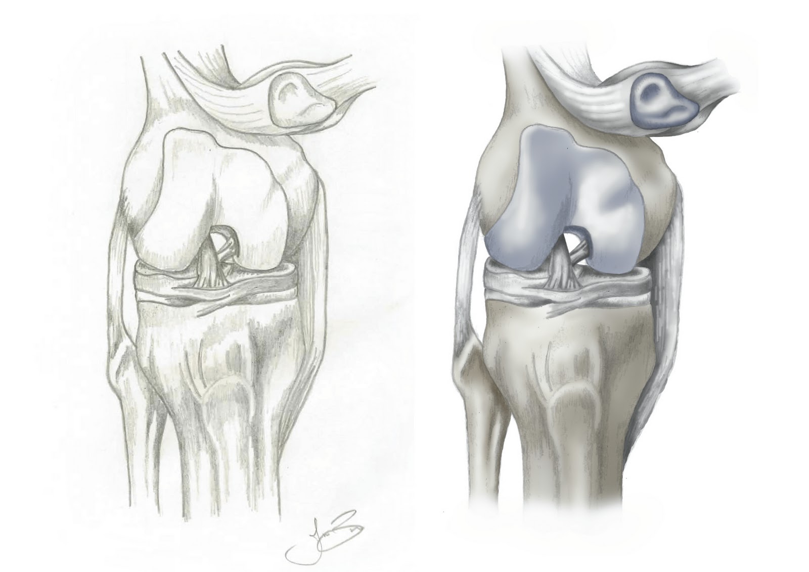 1600x1132 Strange Nostalgia For The Future Knee Anatomy (Sketch And - Knee Sketch