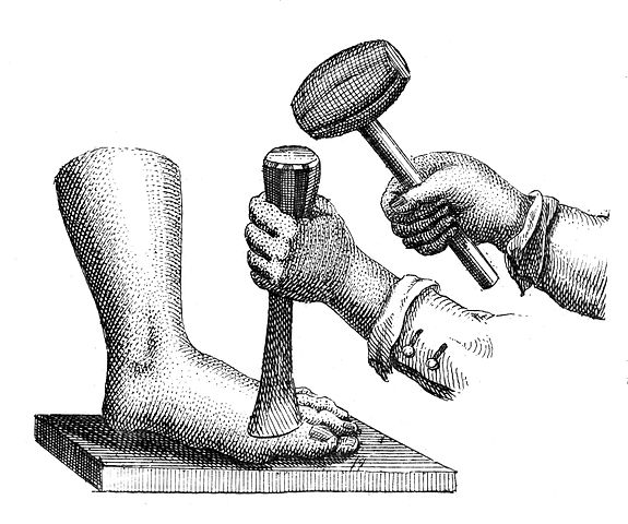 575x480 Filemethod Of Amputating The Great Toe With A Mallet And Chisel - Mallet Sketch