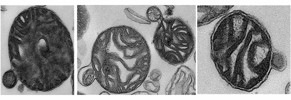 930x320 Tomorrow Edition - Mitochondria Sketch