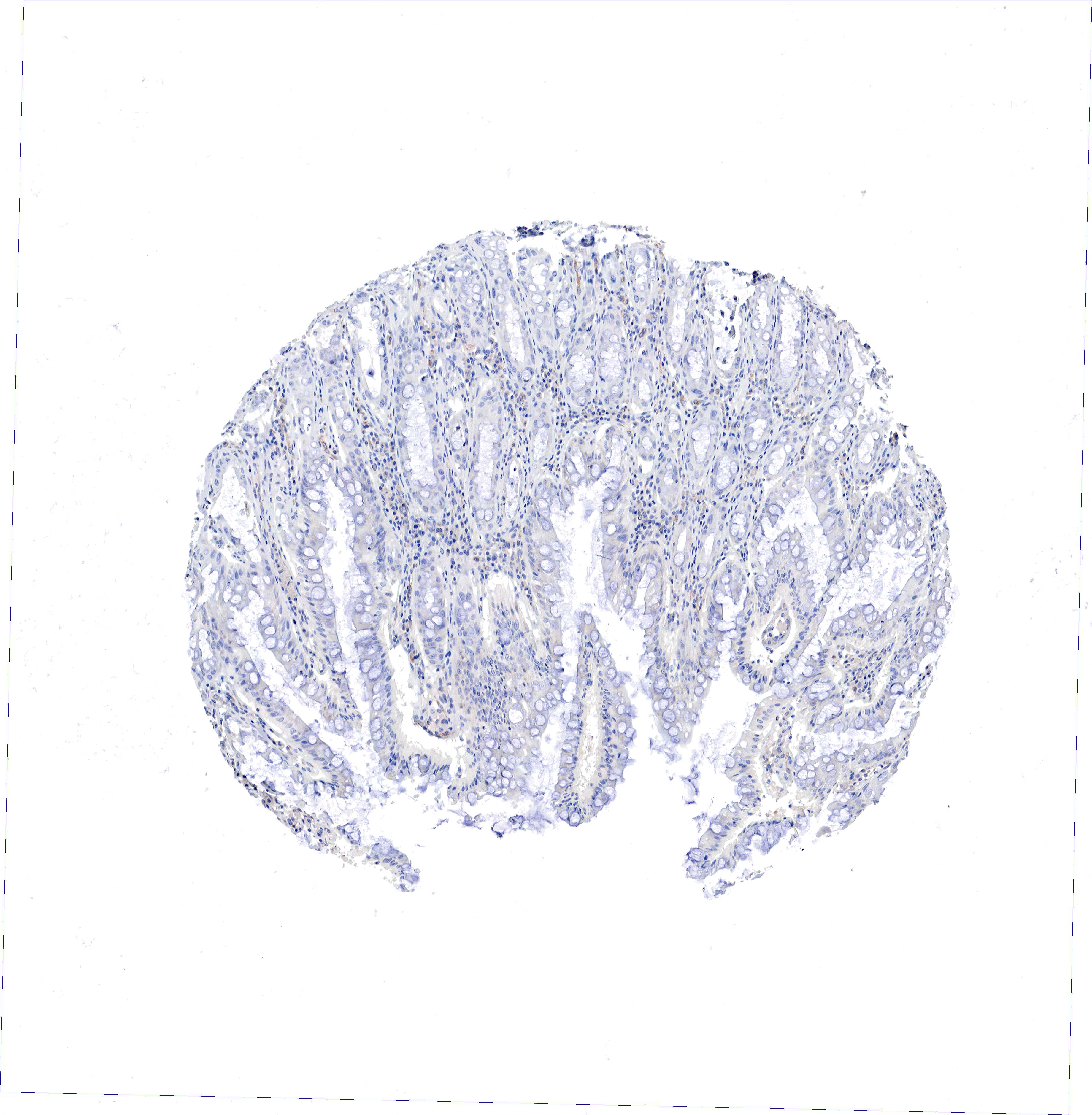 3680x3758 Tissue Expression Of Msn - Msn Sketch
