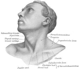 300x263 Torticollis - Neck Sketch