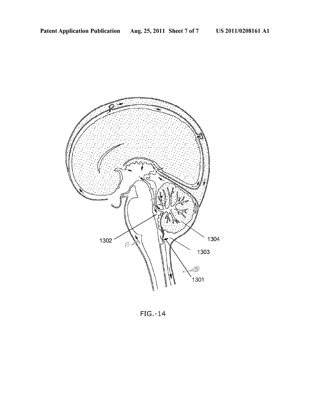 1024x1320 Intracochlear Drug Delivery To The Central Nervous System - Nervous System Sketch