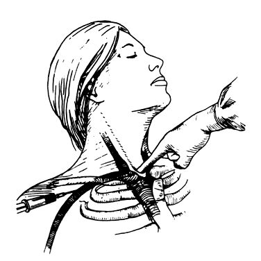 376x376 Nutrition Therapy In The Management Of Gynecologic Malignancies - Nutrition Sketch