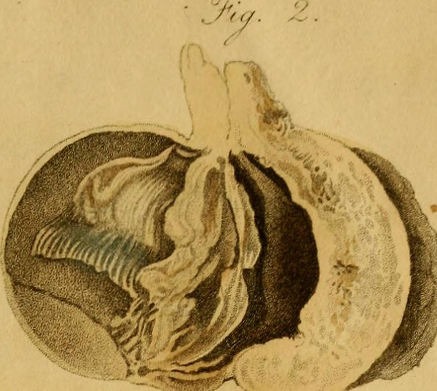 884x792 Image From - Organ Sketch