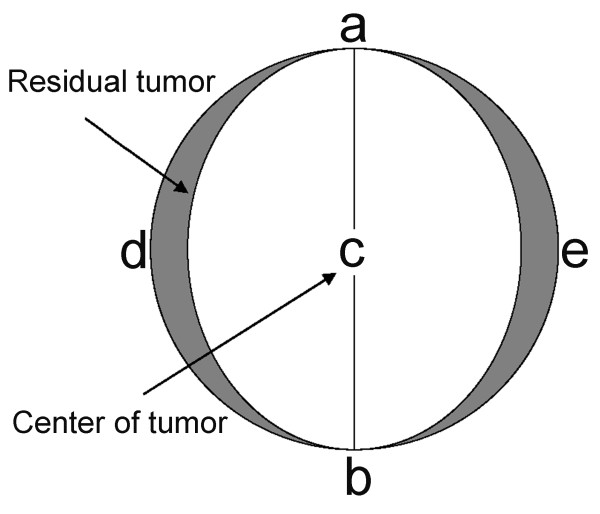600x514 Sketch Of Residual Hepatic Vx2 Carcinoma Following Rfa. The Oval - Oval Sketch