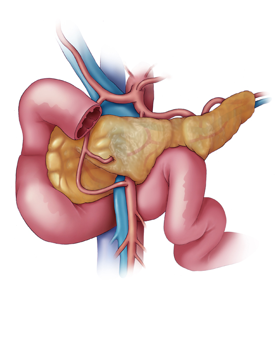 560x700 Medical Illustration Gallery - Pancreas Sketch