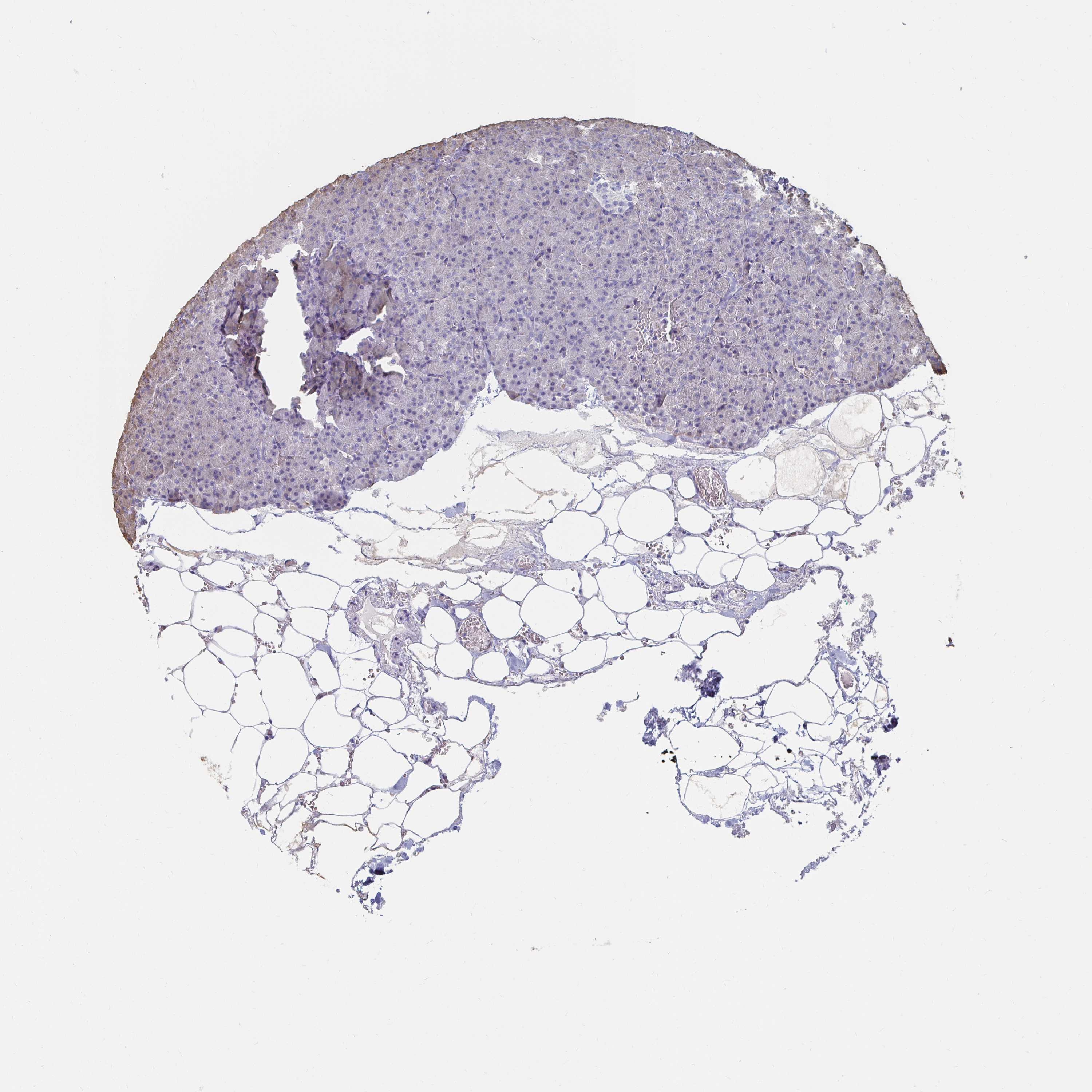 3000x3000 Tissue Expression Of Ca9 - Pancreas Sketch