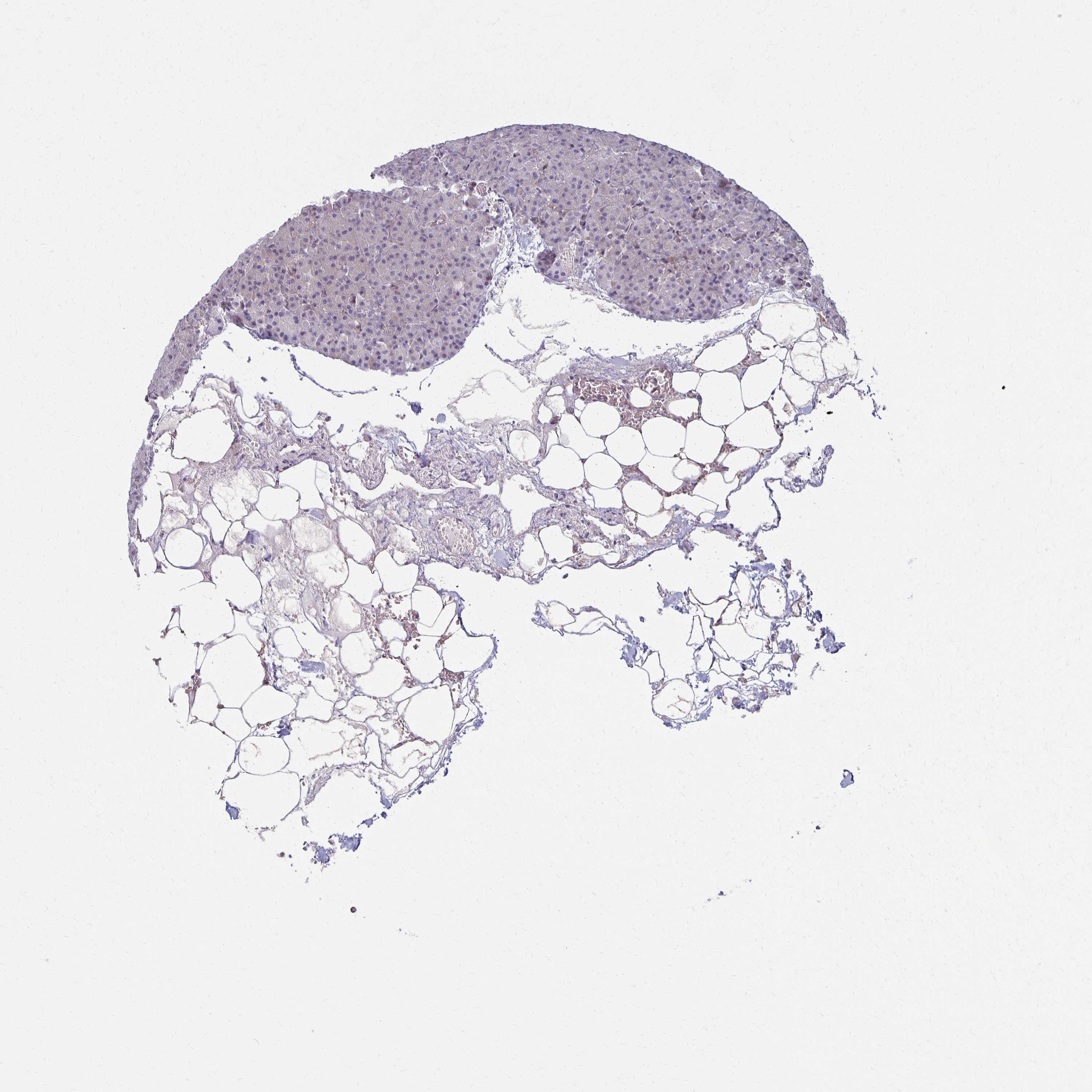3000x3000 Tissue Expression Of Gpx4 - Pancreas Sketch