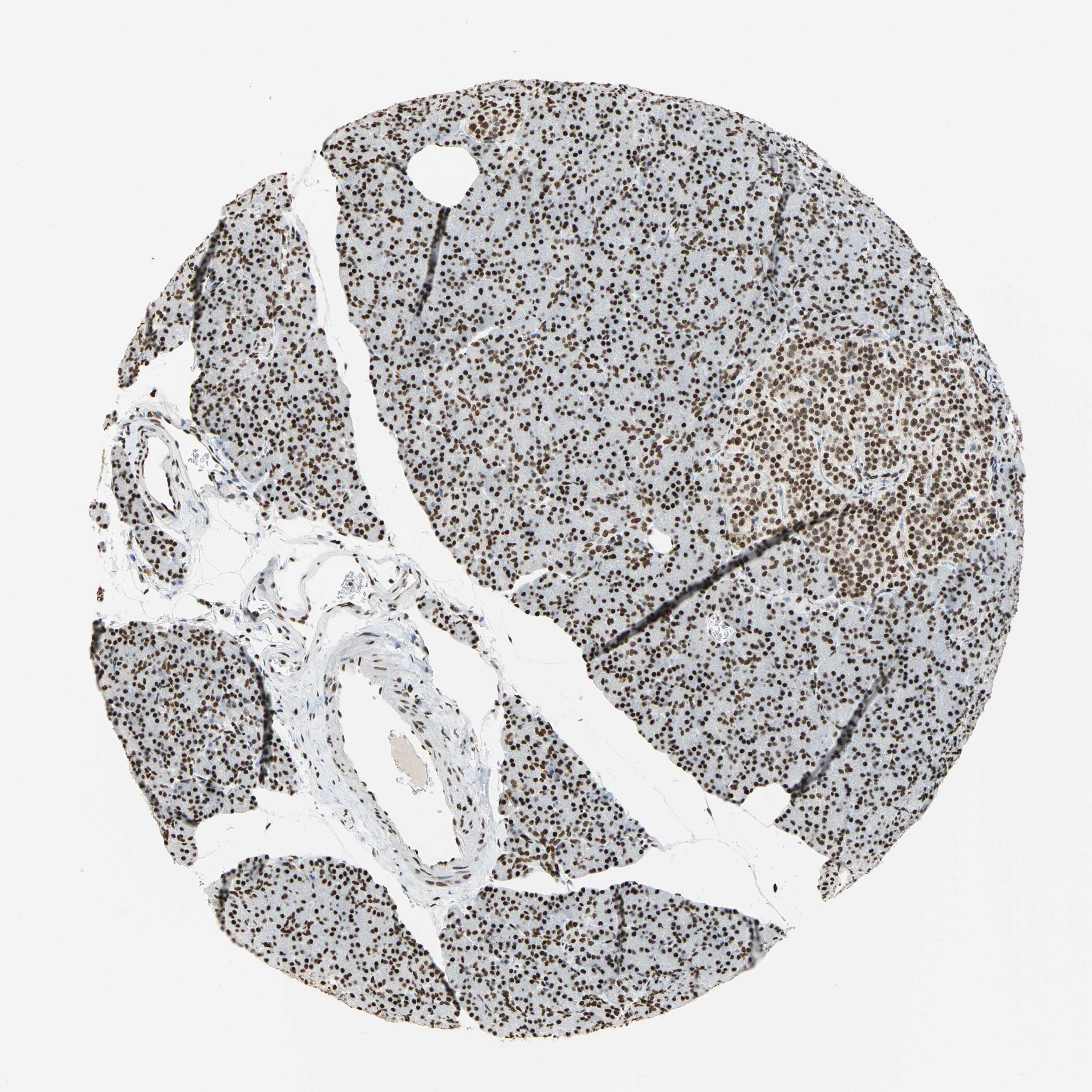3000x3000 Tissue Expression Of Hmgb1 - Pancreas Sketch
