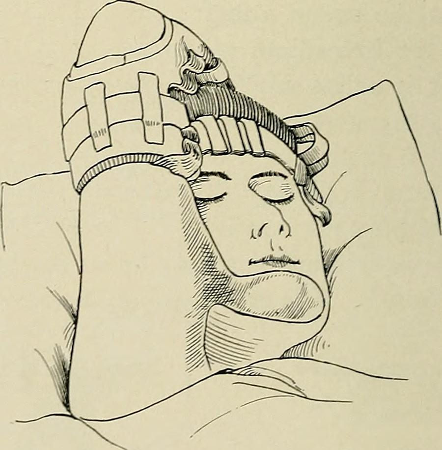 900x916 Image From - Plastic Surgery Sketch