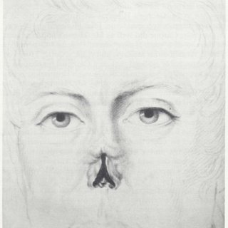 320x320 Pdf) Joseph Constantine Carpue First Military Plastic Surgeon. - Plastic Surgery Sketch