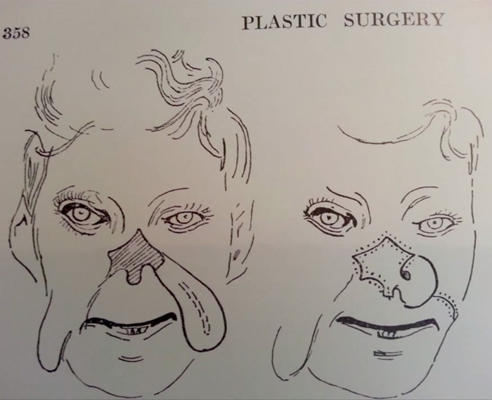 700x570 Pickerill And Gillies Great War Story Nzhistory, New Zealand - Plastic Surgery Sketch