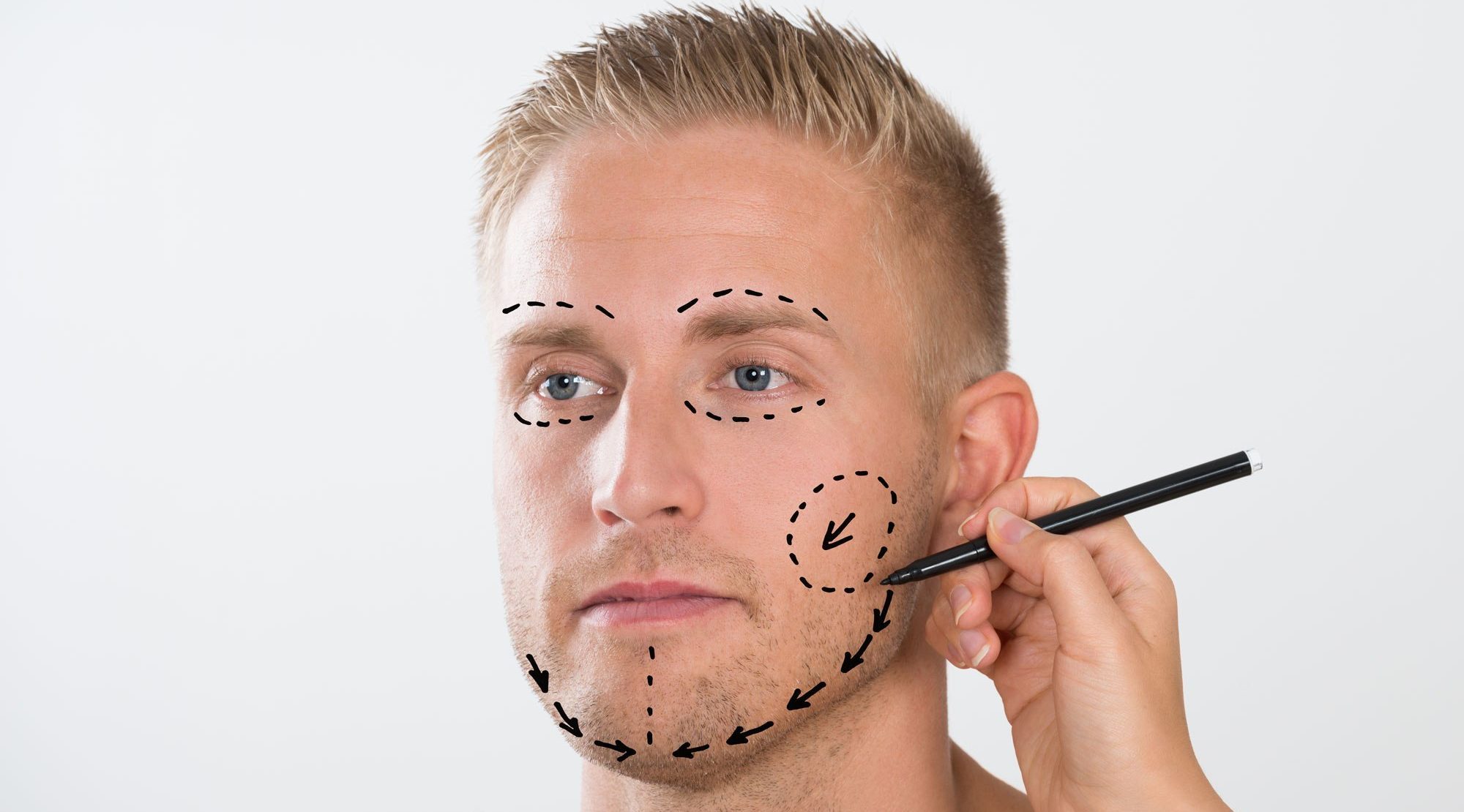 2000x1110 Plastic Surgery For Men Has Seen A Spike In 2017. What Did They - Plastic Surgery Sketch