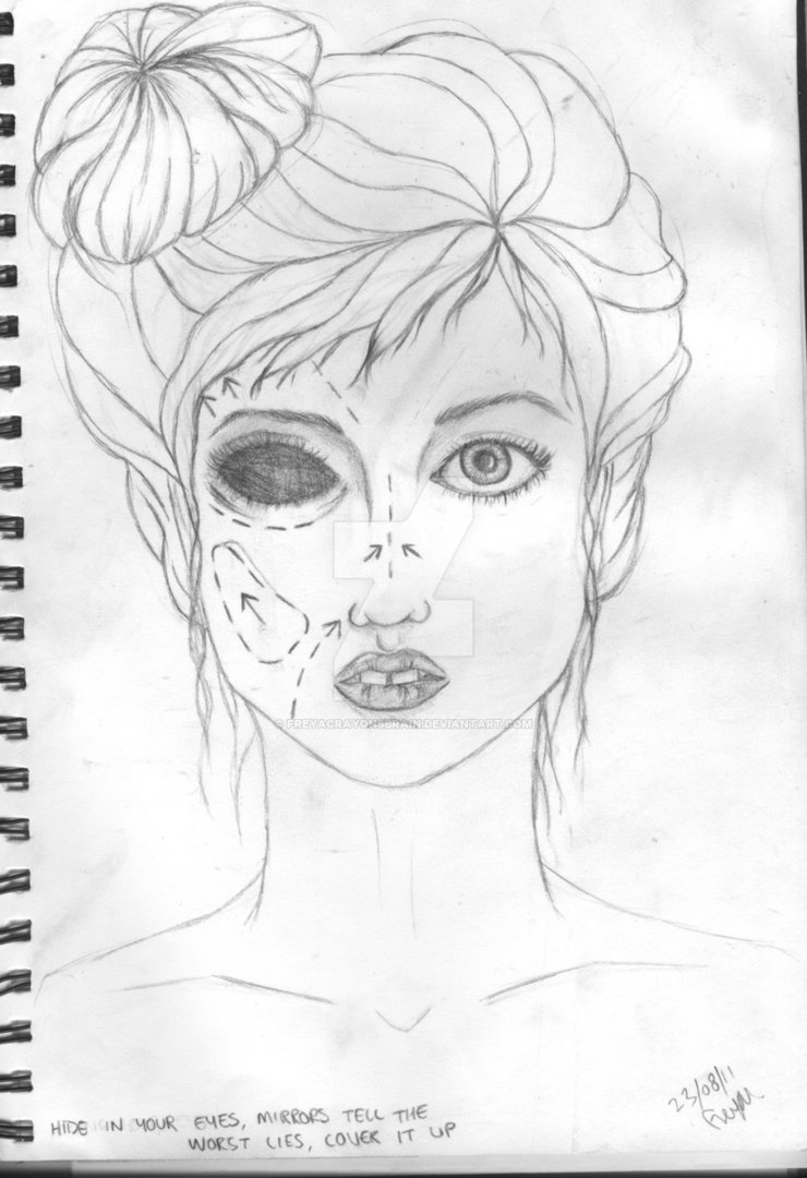 740x1080 Plastic Surgery Whore Drawing By Freyacrayonsbrain - Plastic Surgery Sketch