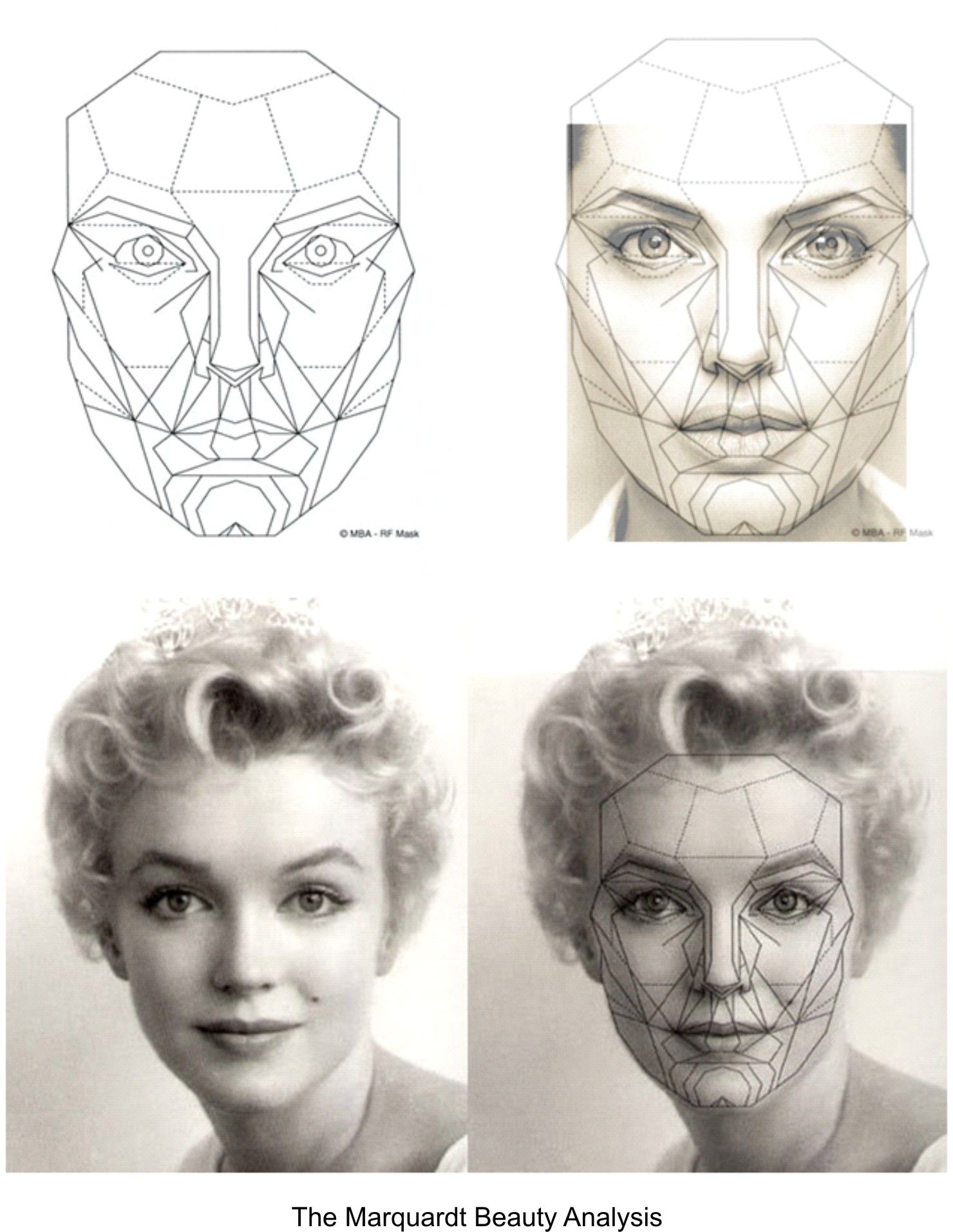 1480x1913 What Accounts For Beauty Marquardt Mask Changes Plastic Surgery - Plastic Surgery Sketch