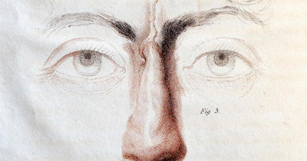 1200x630 Almanac Birth Of Plastic Surgery - Plastic Surgery Sketch