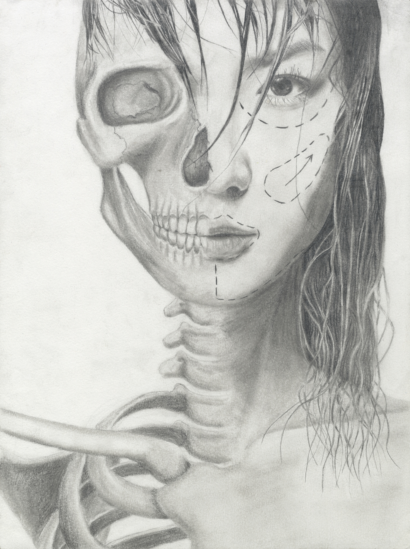 1400x1874 Anatomical Sketch - Plastic Surgery Sketch